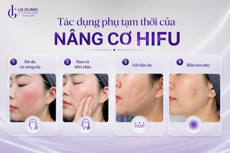 tác dụng phụ của nâng cơ hifu