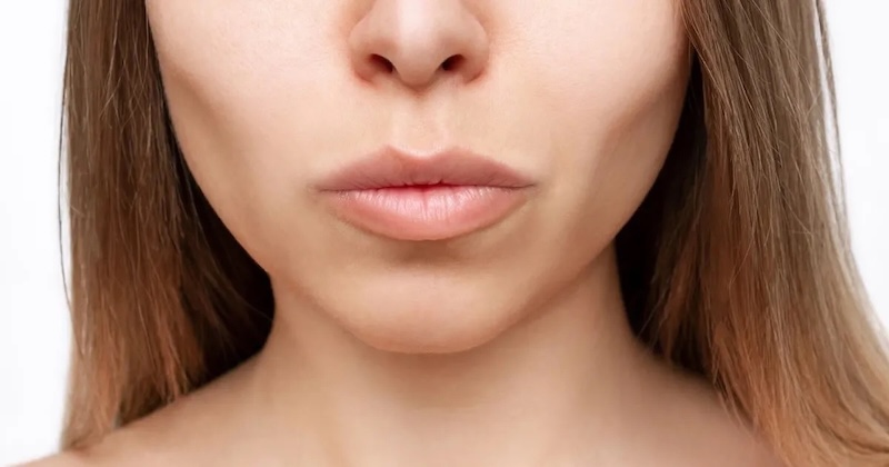 tác hại của nâng cơ hifu