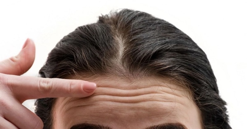 trán có 3 nếp nhăn ngang