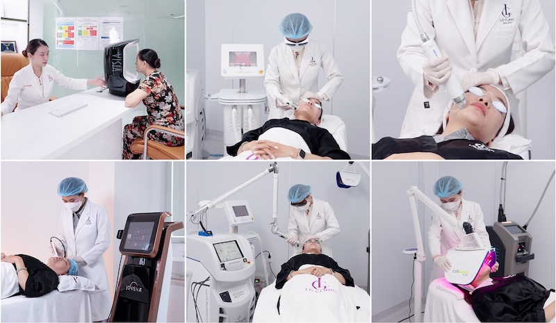 công nghệ nâng cơ mặt mới nhất