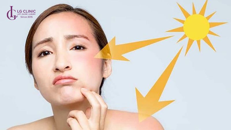 Tác động từ ánh nắng mặt trời chính là nguyên nhân gây nên lão hóa sớm
