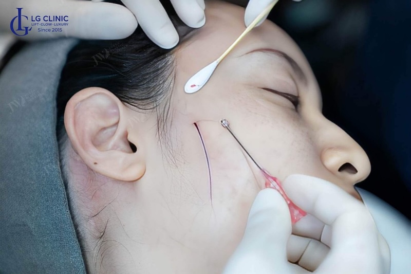 phục hồi làn da bị lão hóa