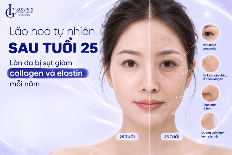 30 tuổi da mặt chảy xệ
