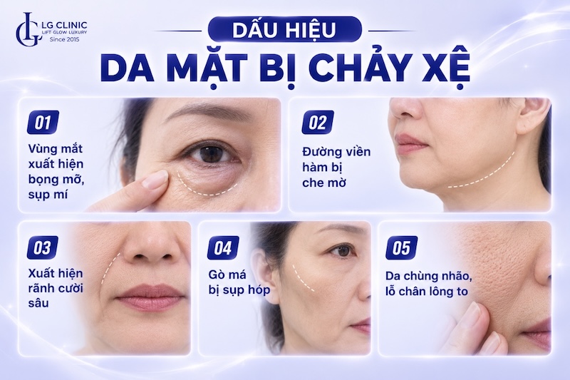 dấu hiệu da mặt chảy xệ