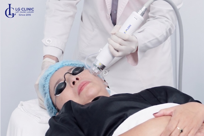 làm gì khi da mặt bị chảy xệ
