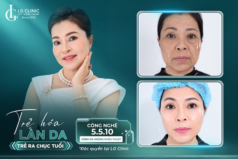 điều trị da mặt chảy xệ