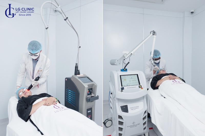 cách khắc phục da mặt bị chảy xệ