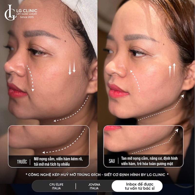 cách có đường viền hàm