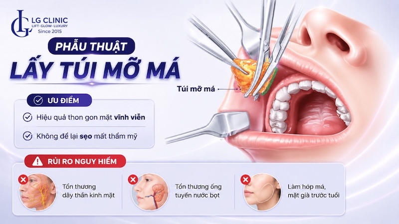 lấy mỡ má