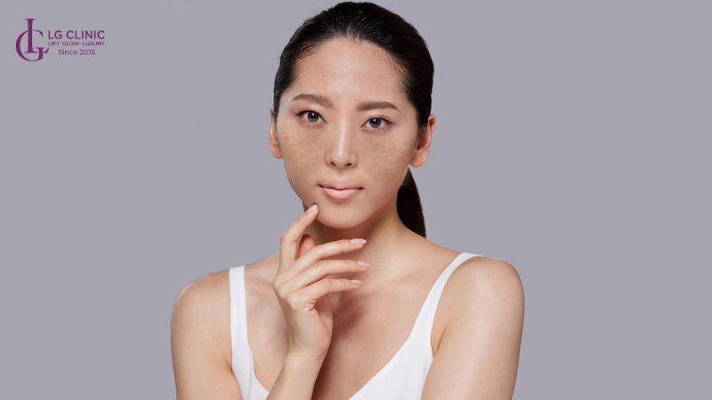 nám có trị tận gốc được không