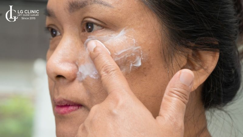 nám có trị tận gốc được không