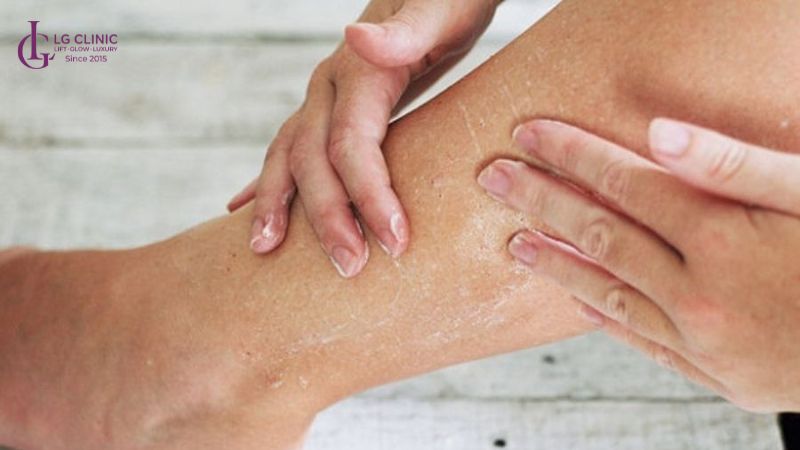 tác hại của tắm trắng bằng cám gạo