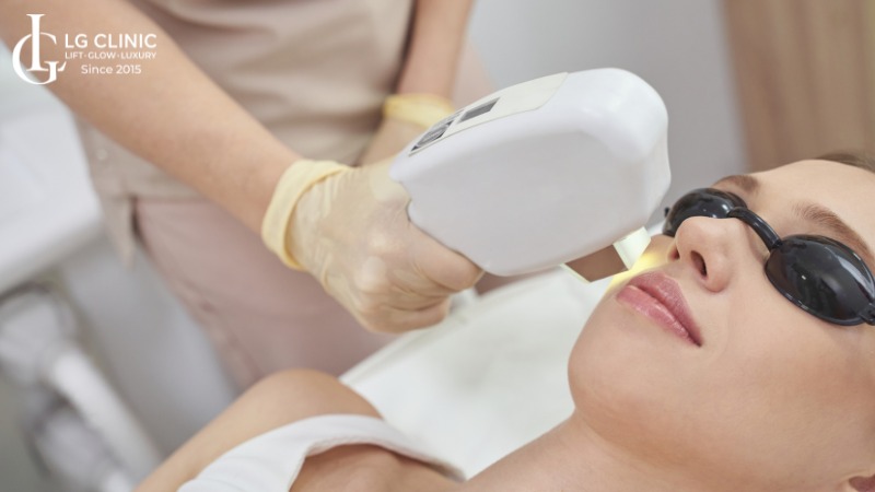 Triệt lông mặt có thu nhỏ lỗ chân lông không