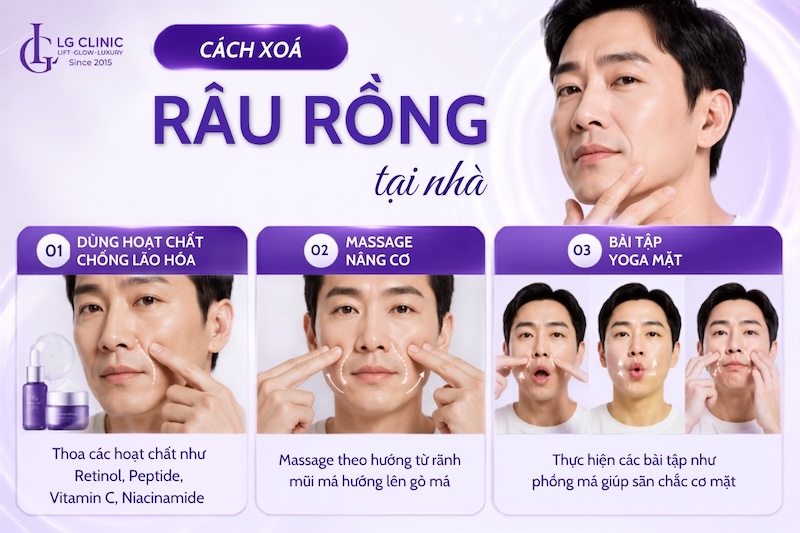 xoá râu rồng ở đàn ông