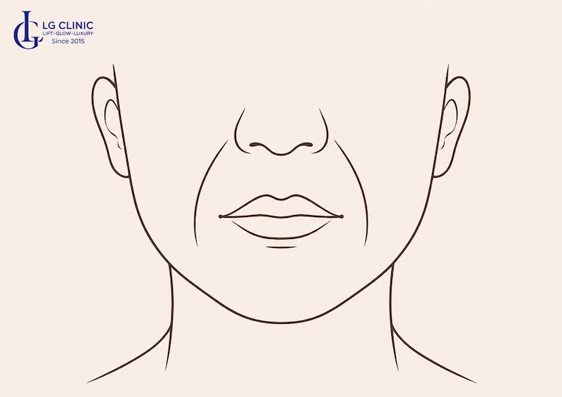 phụ nữ có râu rồng