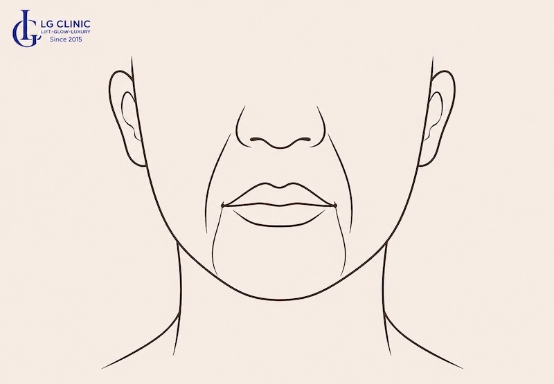 râu rồng phụ nữ