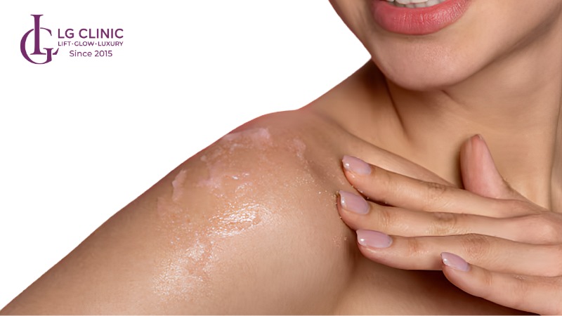 Bao lâu nên lột da 1 lần