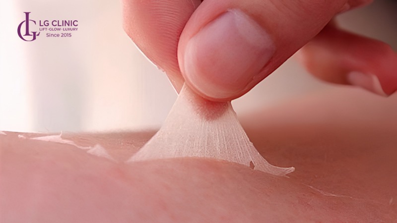 Bao lâu nên lột da 1 lần