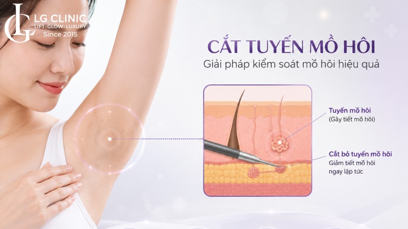 cách để không bị chảy mồ hôi nách