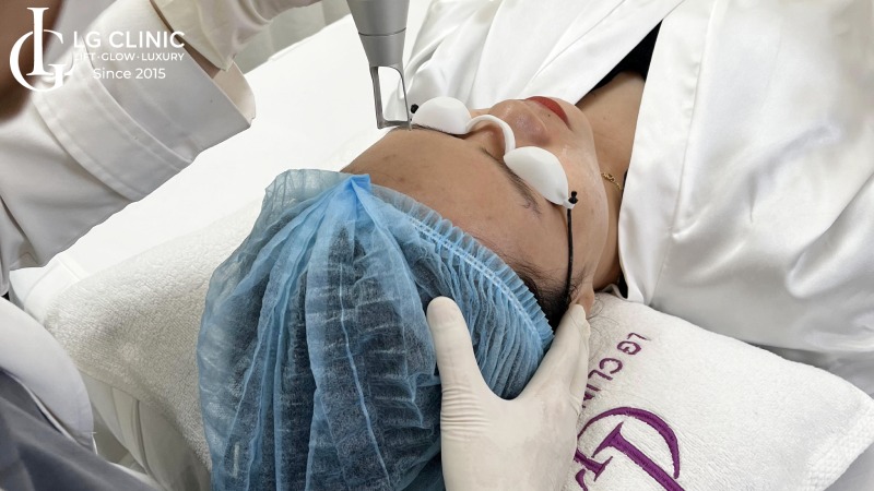 Cách trị sẹo thâm thủy đậu