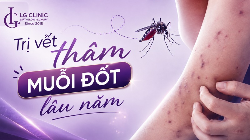 cách trị vết thâm muỗi đốt lâu năm