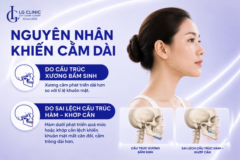 cằm dài