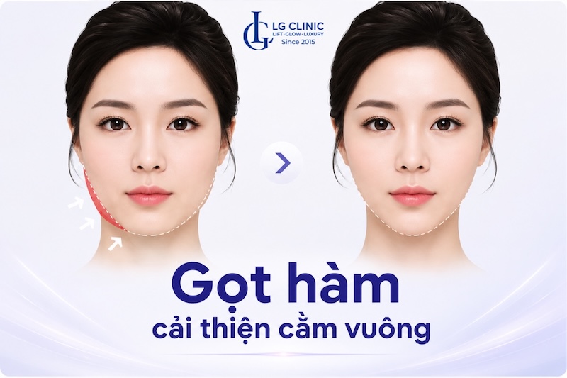 cách làm cằm thon gọn