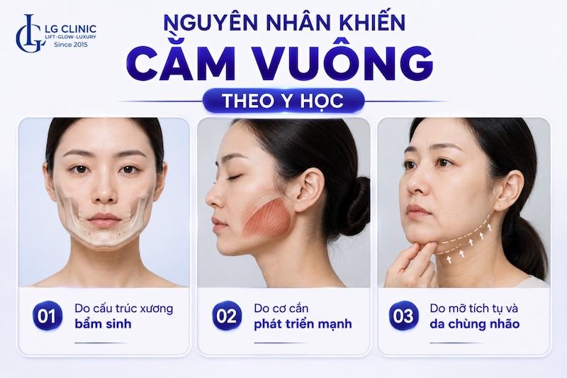 cằm vuông