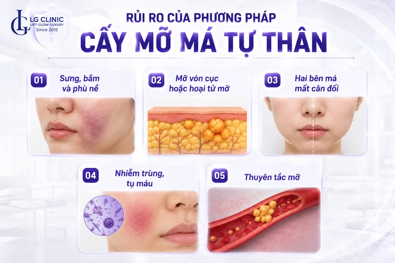 cấy mỡ má tự thân