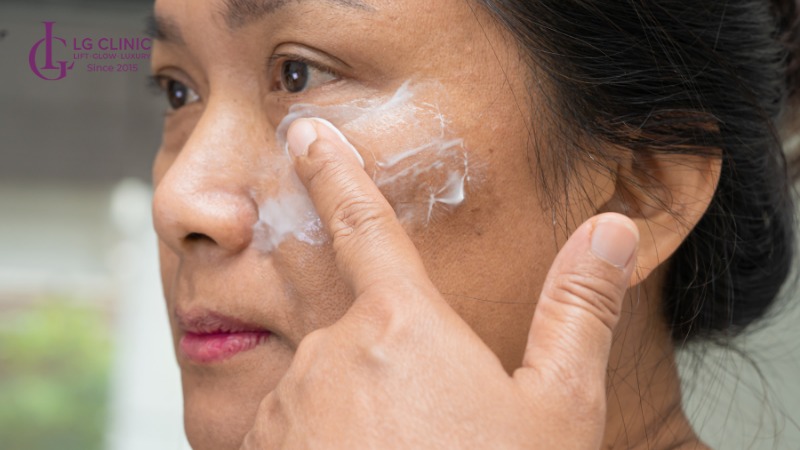 Có nên dùng kem trị nám không