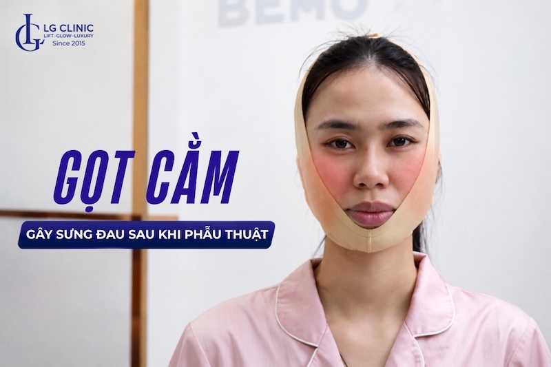 gọt cằm có đau không