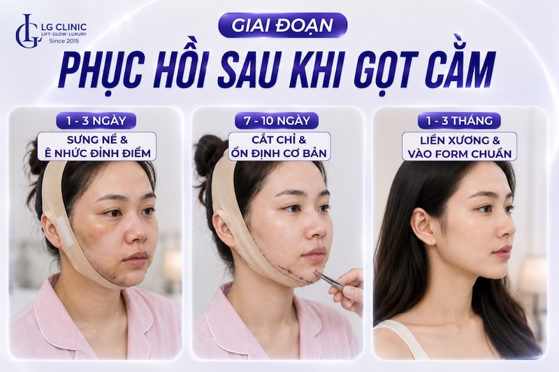 gọt cằm có đau không