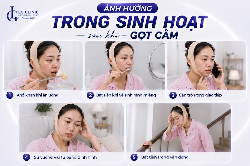 gọt cằm đau không