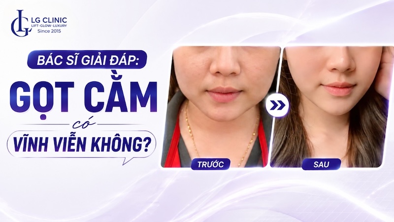Gọt cằm có vĩnh viễn không