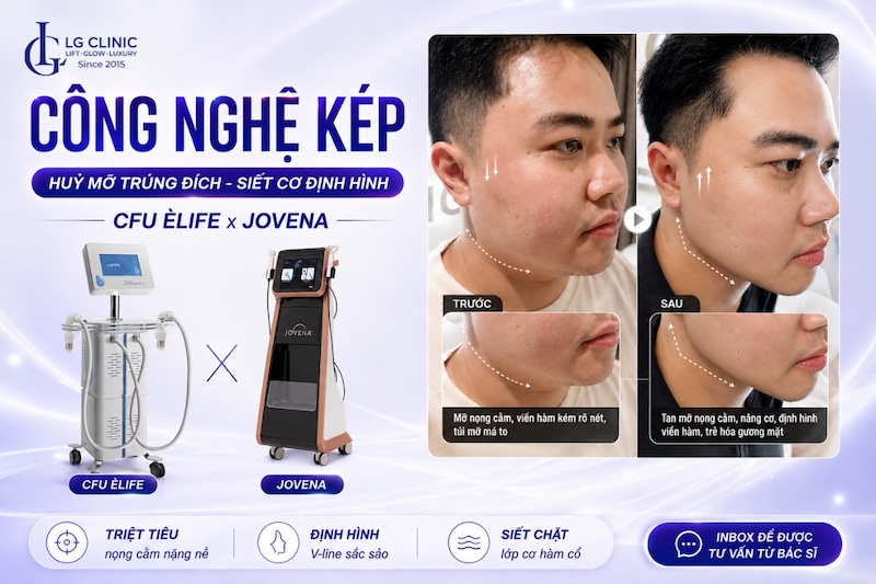 cách làm mặt thon gọn
