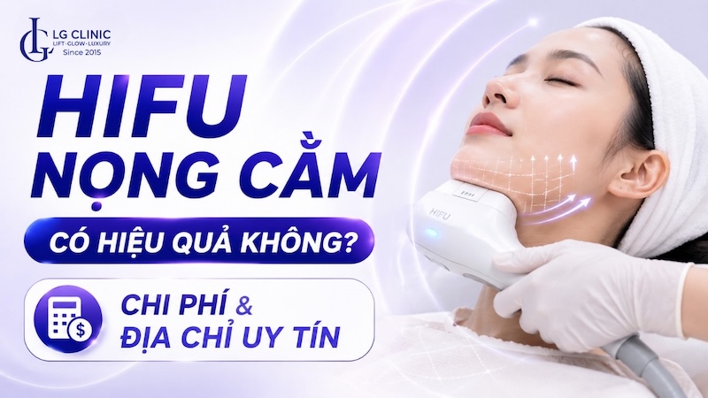 hifu nọng cằm