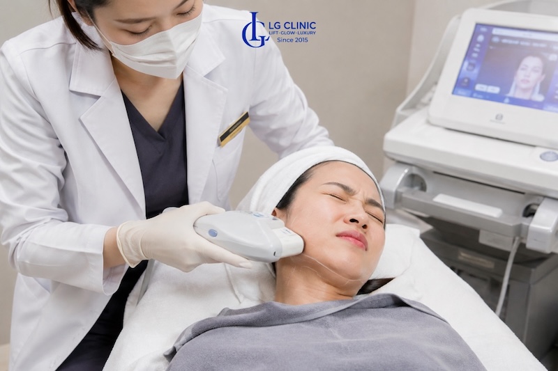 hifu nọng cằm