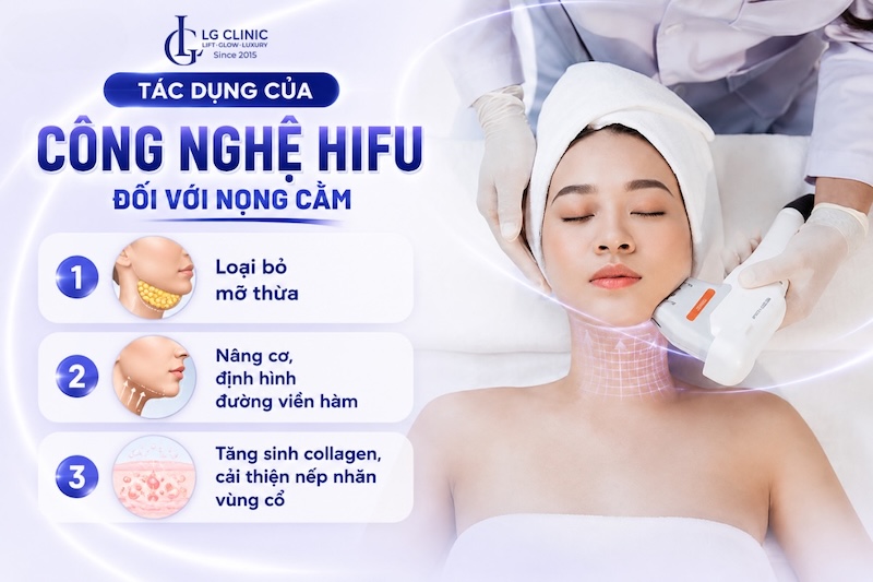hifu nọng cằm