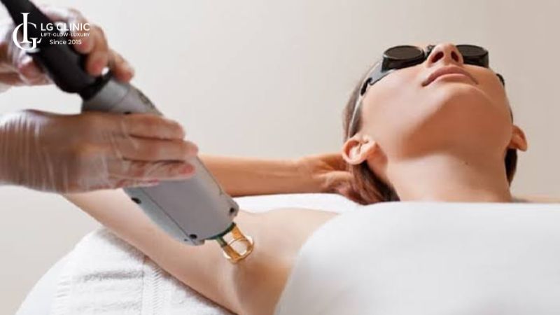 hôi nách có chữa được không