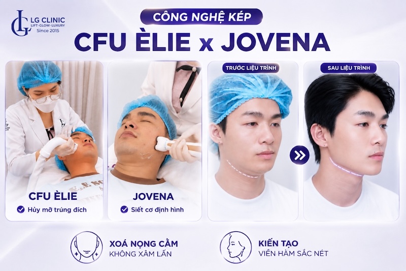 giảm mỡ nọng cằm