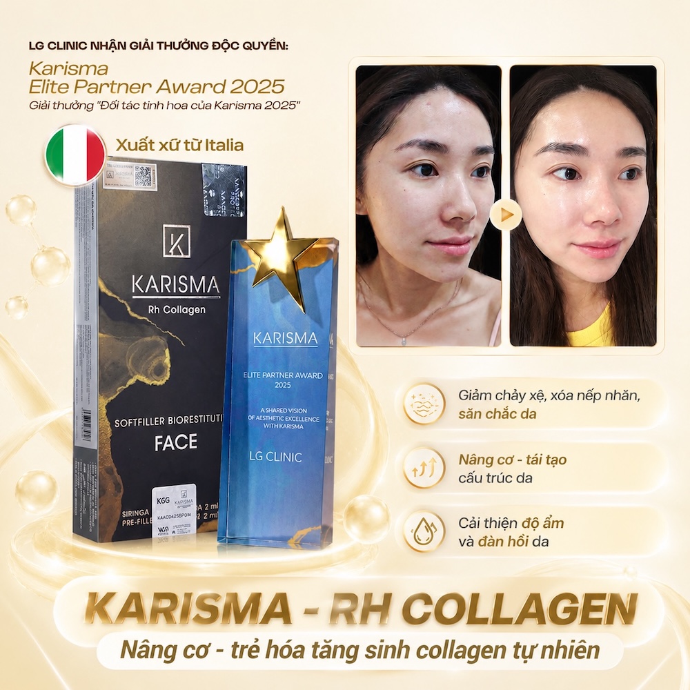 karisma rh collagen