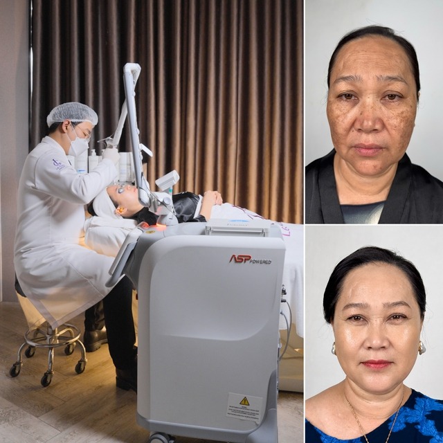 LG Clinic tiếp tục đầu tư Fotona StarWalker® QX, gia tăng quy mô hệ sinh thái công nghệ cao trong điều trị da