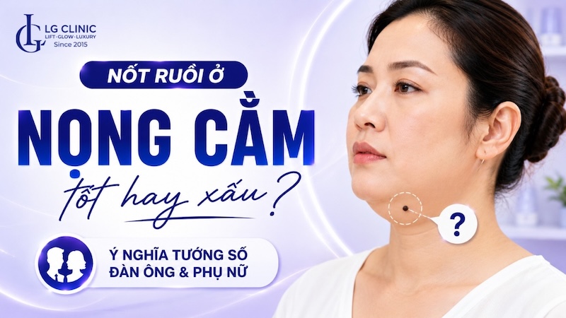nốt ruồi ở nọng cằm