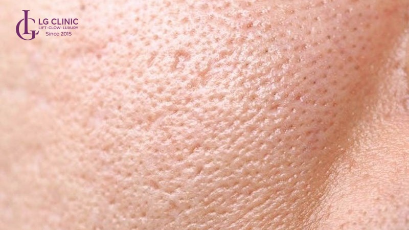 spa thu nhỏ lỗ chân lông Bình Tân