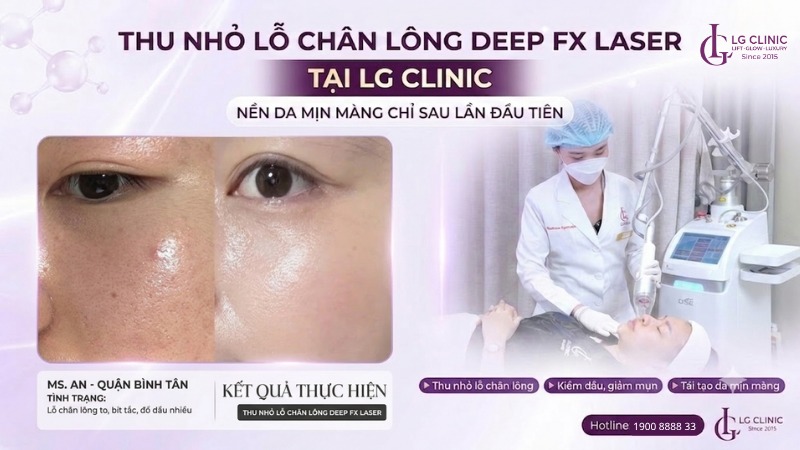 spa thu nhỏ lỗ chân lông Bình Tân