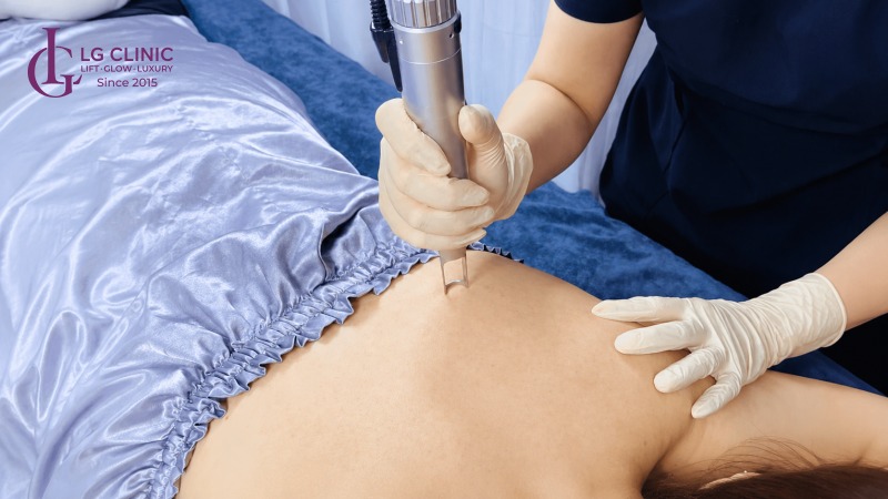 spa trị mụn lưng Gò Vấp