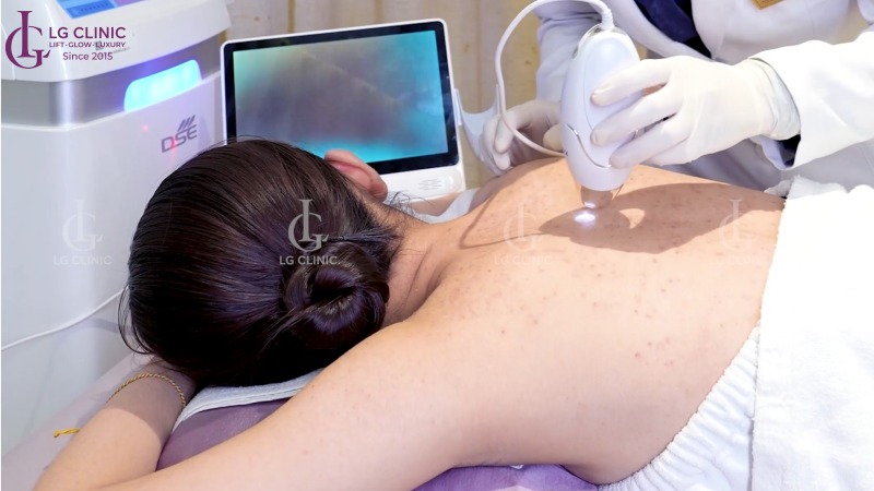 spa trị mụn lưng Gò Vấp
