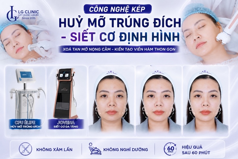 tan mỡ nọng cằm
