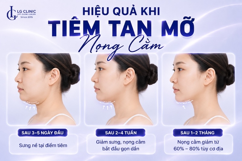 tiêm tan mỡ nọng cằm bao lâu có hiệu quả