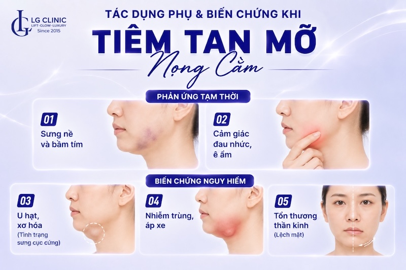 review tiêm tan mỡ nọng cằm